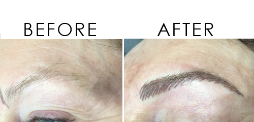 BA-Eyebrow-Tattoo-2